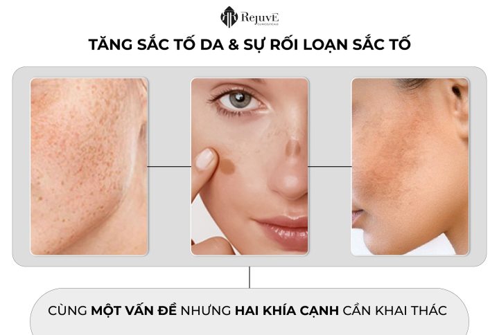 ĐỊNH NGHĨA TĂNG SẮC TỐ DA VÀ SỰ RỐI LOẠN SẮC TỐ DA LÀ GÌ